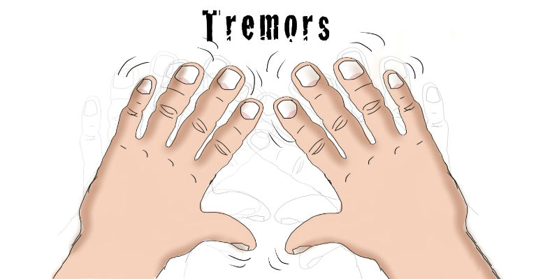 10 Natural Remedies for Essential Tremor in Hands Featured