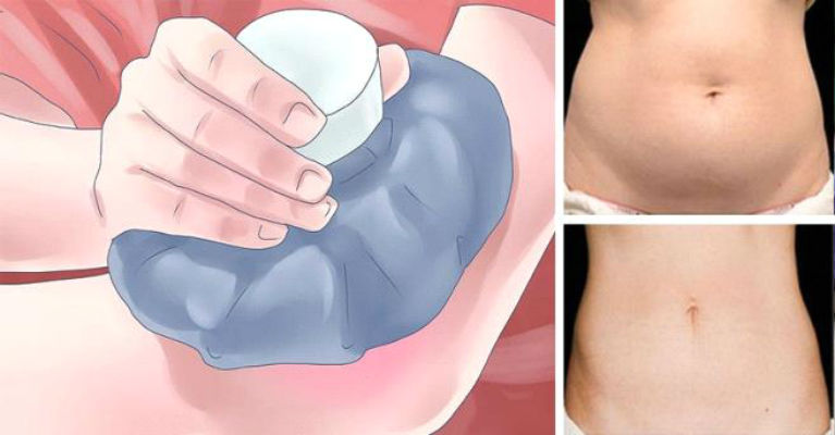 Kill Fat Cells Instantly Just By Freezing Them! (You’ll Never Believe How It Works)