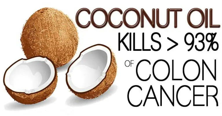 Coconut Oil Kills 93 percent of Colon Cancer Cells