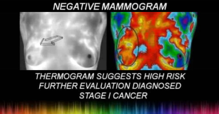 Mammograms Don’t Help They Harm Women - Featured