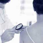 16 Visible Skin Changes - Warning Cancer Symptoms