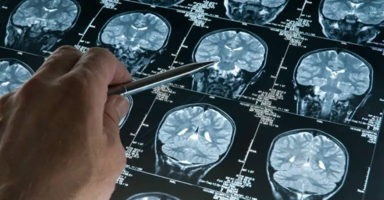 What Fasting Does To Your Brain & Why Big Pharma Won’t Study It