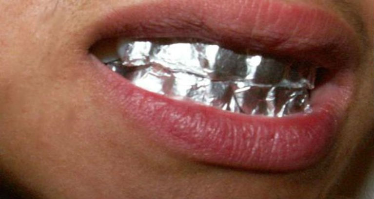 What Will Happen If You Keep Aluminum Foil on Your Teeth for 1 Hour
