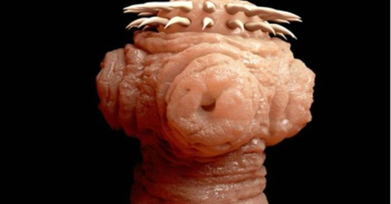 Shocking Worms Can Grow Inside You and Invade Your Body From Eating THIS Common Food!