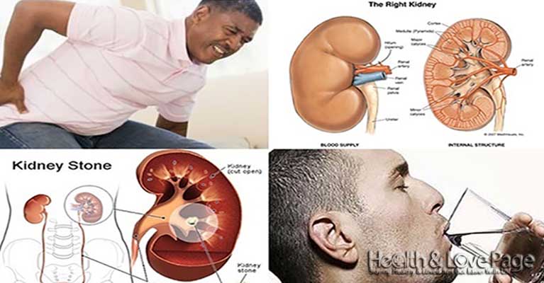 The most effective natural remedy for melting kidney stones and gall bladder!