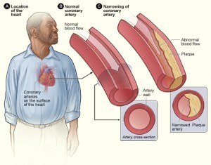 cholesterol and the body
