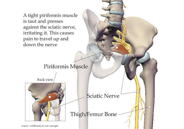 The Hidden Muscle Causing Your Sciatica Pain And 2 Easy Stretches For INSTANT Relief 1