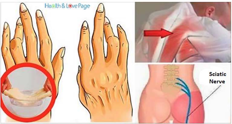 This Little Known SIMPLE TRICK Will Help You Fight Arthritis, Sciatica and Backache Better Than Pills!