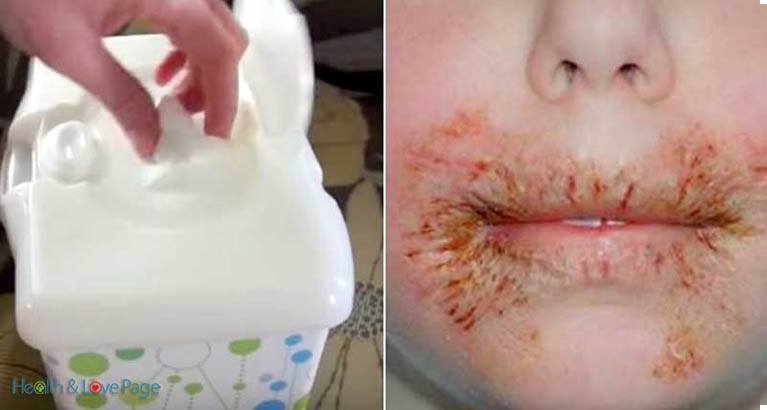 Doctor's Warning: Never Clean Your Child With Baby Wipes No Matter What