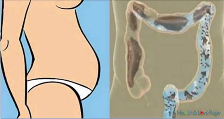 Feeling Bloated? What You Should Do to Relieve Constipation and Bloating in a Few Minutes