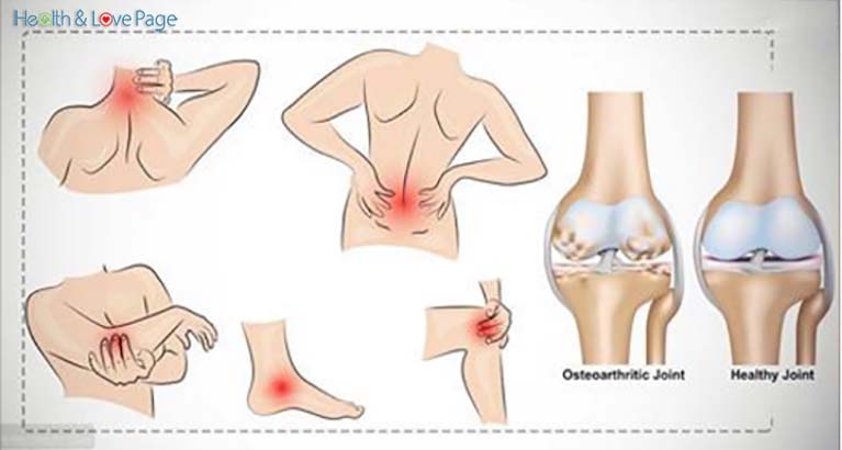 Joint Pain: Causes, Symptoms and 10 Treatments
